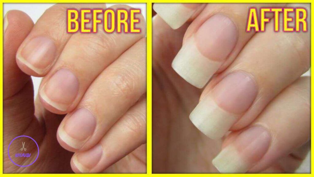 How to Grow Nails Faster Naturally