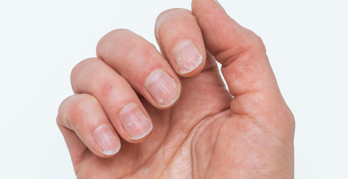 How to Strengthen Weak Nails Naturally