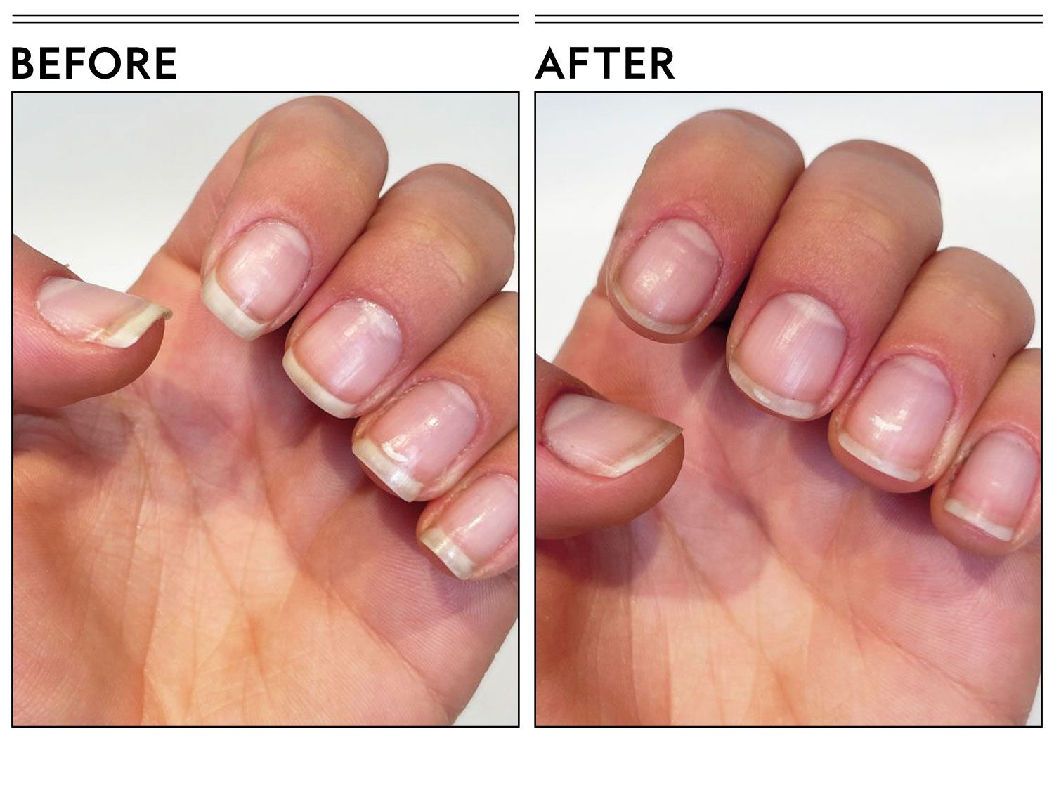 Best Oils for Nail Growth